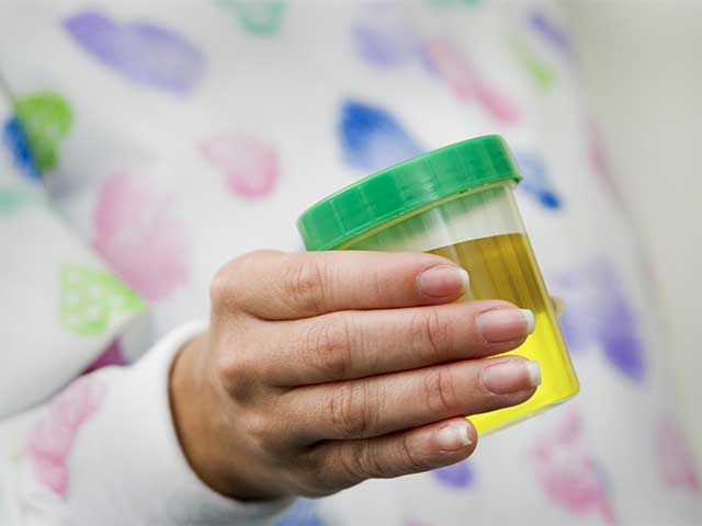 Why does Urine Color Change to Yellowish during Pregnancy? or why is there a change in urine colour during early pregnancy?